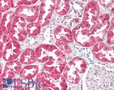 IHC-plus™ Polyclonal Goat anti-Human KHK / Ketohexokinase Antibody (IHC, WB)