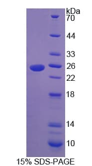 Human GGTLA1 / GGT5 Protein (Recombinant His)