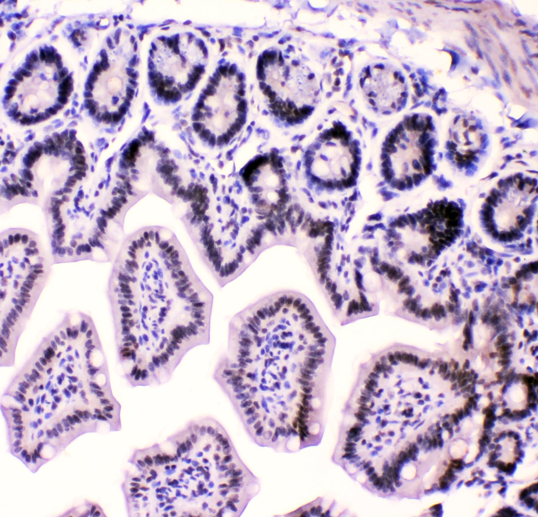HNRNPF / hnRNP F Antibody