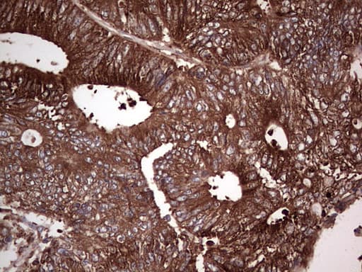 PKM2 Antibody (clone 12B9)