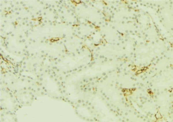 PLTP Antibody