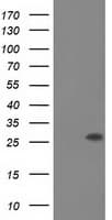 OTUB2 Antibody (clone OTI11B3)