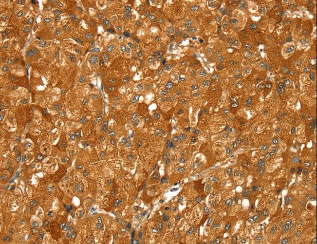 Polyclonal Rabbit anti-Human PYGM Antibody (IHC, WB)