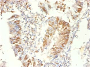 Polyclonal Rabbit anti-Human PSME3 Antibody (IHC, WB)