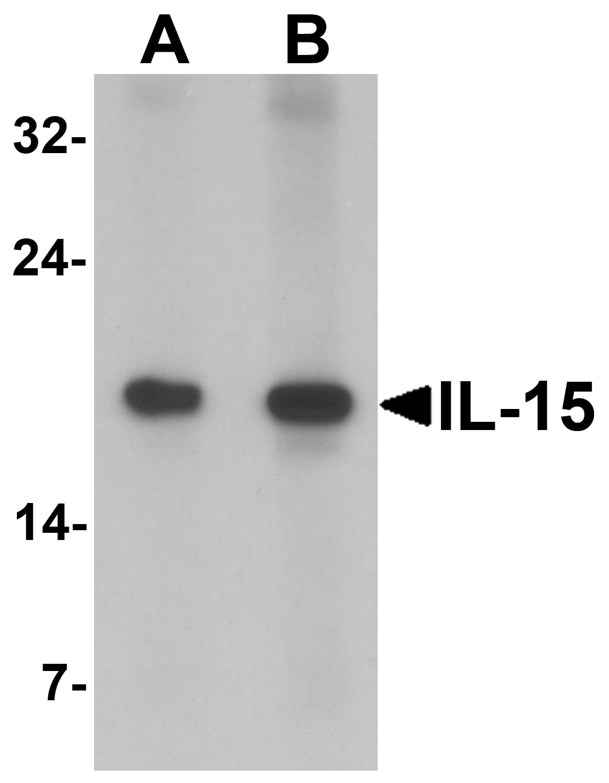 IHC-plus™ Polyclonal Rabbit anti-Human IL15 Antibody (IHC, WB)