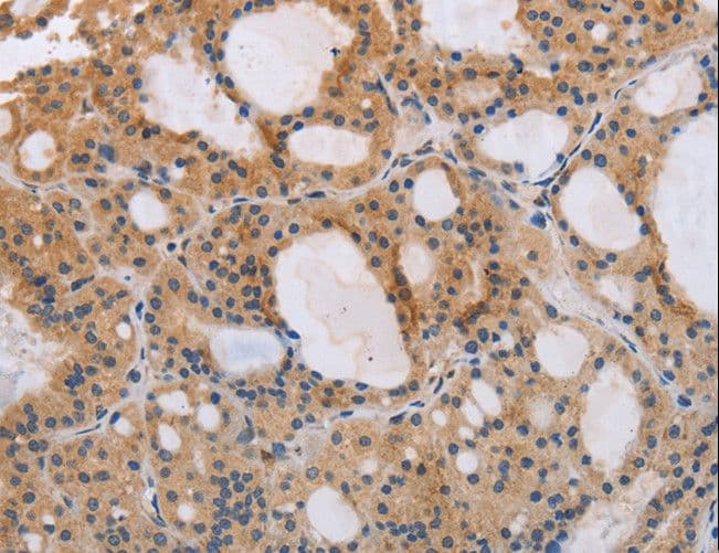ITPR1 / IP3 Receptor Type 1 Antibody