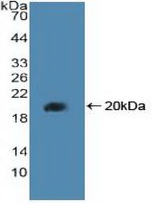 PPARD / PPAR Delta Antibody (aa260-426)
