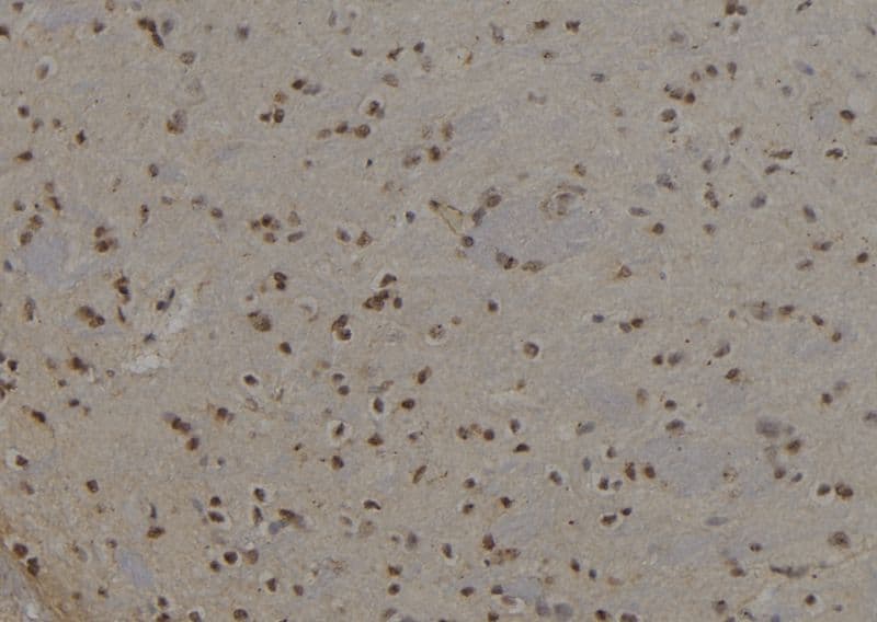 Polyclonal Rabbit anti-Human KRT6A / CK6A / Cytokeratin 6A Antibody (IHC, WB)