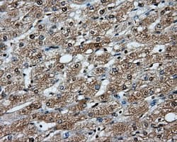 Monoclonal Mouse anti-Human PPP5C Antibody (clone OTI4E1, IHC, WB)