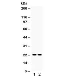 LCN2 / Lipocalin 2 / NGAL Antibody