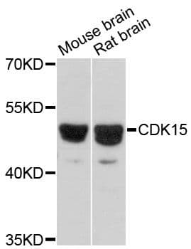 CDK15 / ALS2CR7 Antibody