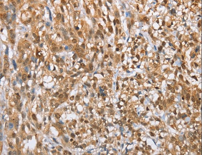 Polyclonal Rabbit anti-Human MMP12 Antibody (IHC)