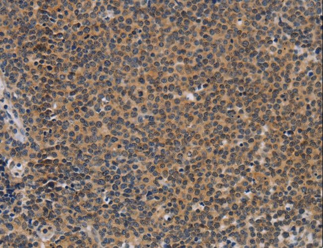 CD30 Antibody