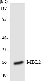 MBL2 / Mannose Binding Protein Antibody (aa10-59)