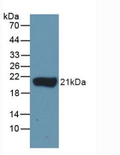 IL-1B / IL-1 Beta Antibody
