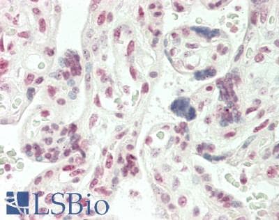 IHC-plus™ ARHGAP17 / NADRIN Antibody (aa41-70)