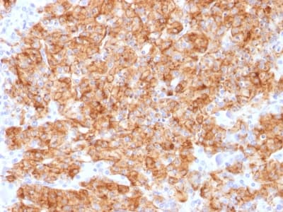 Recombinant Monoclonal Rabbit anti-Human CHGA / Chromogranin A Antibody (clone CHGA/1773R, Azide-free,Carrier-free, IHC)
