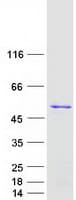 Human TRNT1 / CCA1 Protein (Recombinant Myc-DDK (Flag))