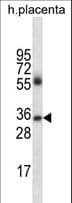 Polyclonal Rabbit Anti-Human IgG4 Secondary Antibody (WB)