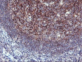 NAPE-PLD Antibody (clone OTI3D5)