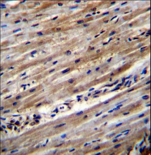 DUS1L Antibody (aa321-349)