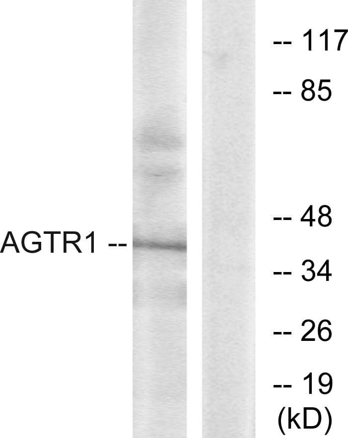 AGTR1 / AT1 Receptor Antibody