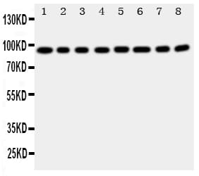 F8 / FVIII / Factor VIII Antibody (aa1264-1278)