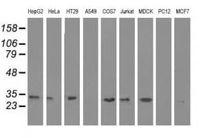 Monoclonal Mouse anti-Human ERCC1 Antibody (clone OTI2A9, IF, WB)