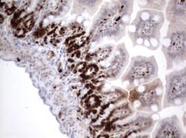 Monoclonal Mouse anti-Human MKI67 / Ki67 Antibody (clone OTI9H1, aa1160-1493, IHC)