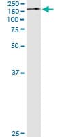 TRIM24 / TIF1 Antibody (clone 2F2)