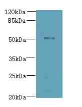 Polyclonal Rabbit anti-Human ZNF410 Antibody (aa1-300, WB)