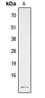 PTH / Parathyroid Hormone Antibody (Internal)