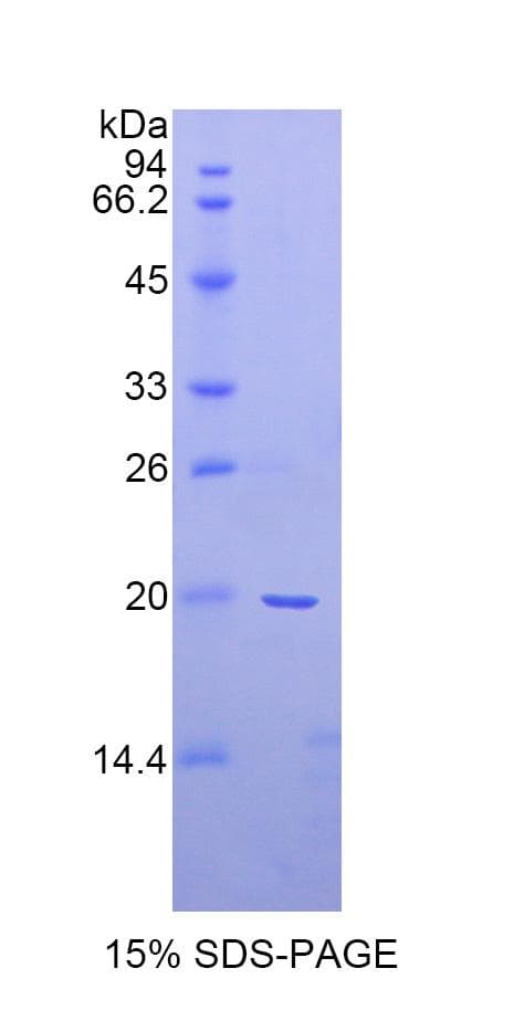 Rat SERPINF2 / Alpha-2-Antiplasmin Protein (Recombinant His)