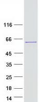 Human HABP4 Protein (Recombinant Myc-DDK (Flag))