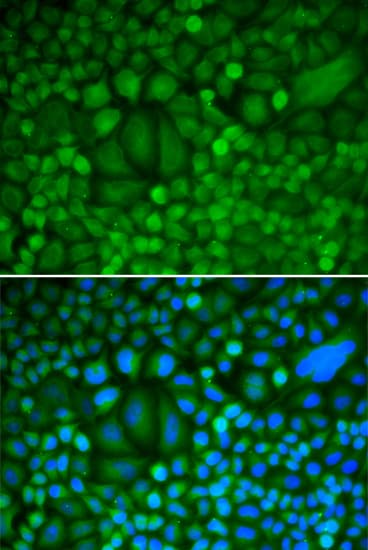 CCNH / Cyclin H Antibody