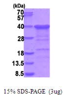 Human CGREF1 Protein (Recombinant His)