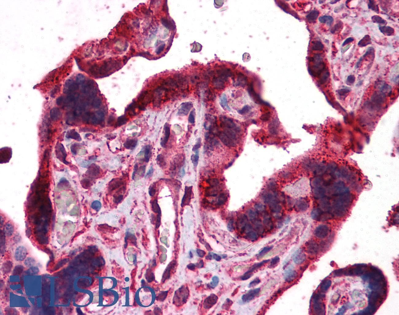 IHC-plus™ Polyclonal Rabbit anti-Human Dipeptidylpeptidase 8 / DPP8 Antibody (IHC, IF, WB)
