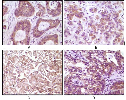 IKBIP Antibody (clone 10A2C5B3)