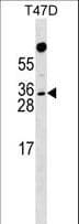 Polyclonal Rabbit anti-Human RHOXF1 Antibody (aa103-129, WB)