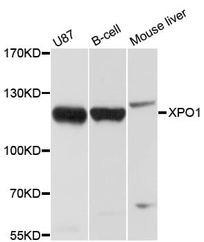Polyclonal Rabbit anti-Human XPO1 / CRM1 Antibody (WB)