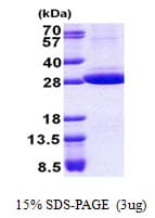 Human STOM / Stomatin Protein (Recombinant His)