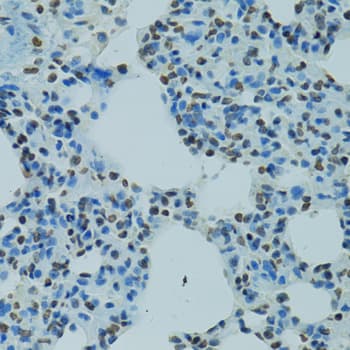 AHR Antibody