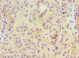 Polyclonal Rabbit anti-Human HDAC6 Antibody (aa160-470, IHC)