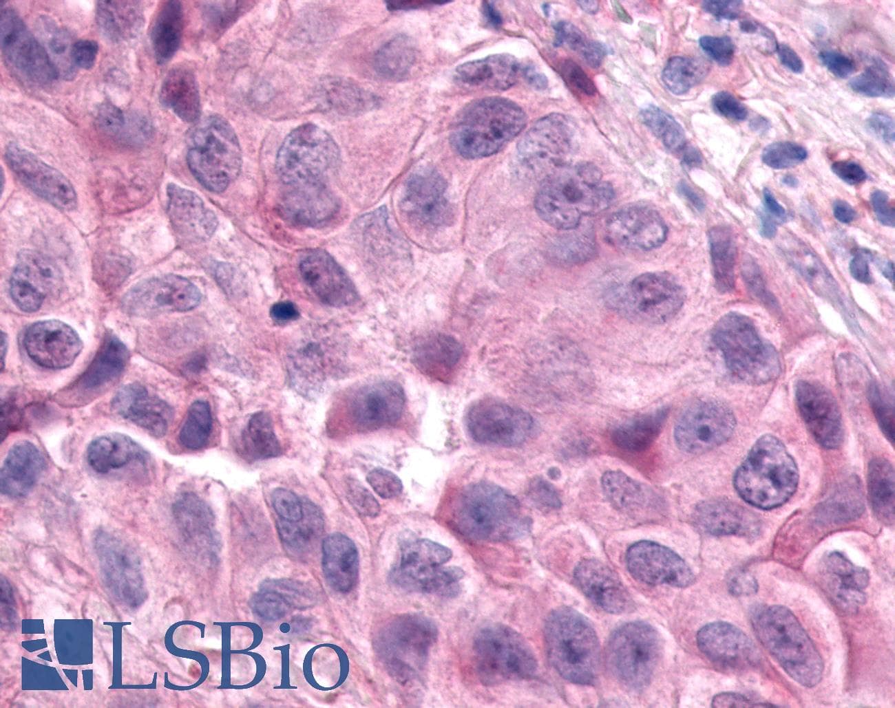 PathPlus™ ESRRA / ERR Alpha Antibody (Internal)