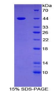 Human Gastrin Protein (Recombinant His-GST)