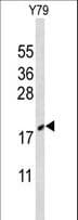 CIRP / CIRBP Antibody (aa145-172)