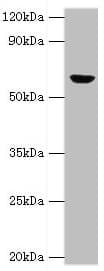 IHC-plus™ Polyclonal Rabbit anti-Human GLUD2 Antibody (aa319-558, IHC, WB)