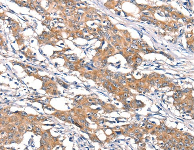 DSC1 / Desmocollin 1 Antibody