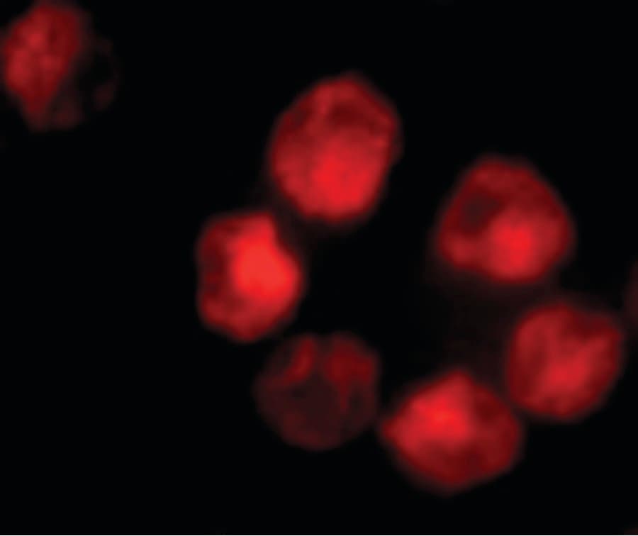 Polyclonal Rabbit anti-Human ADAM10 Antibody (IHC, IF, WB)