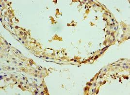 ZMYND10 Antibody (aa201-440)